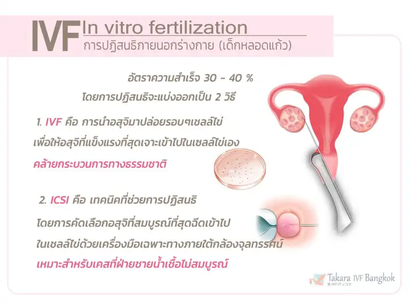 IVF - In Vitro Fertilization 