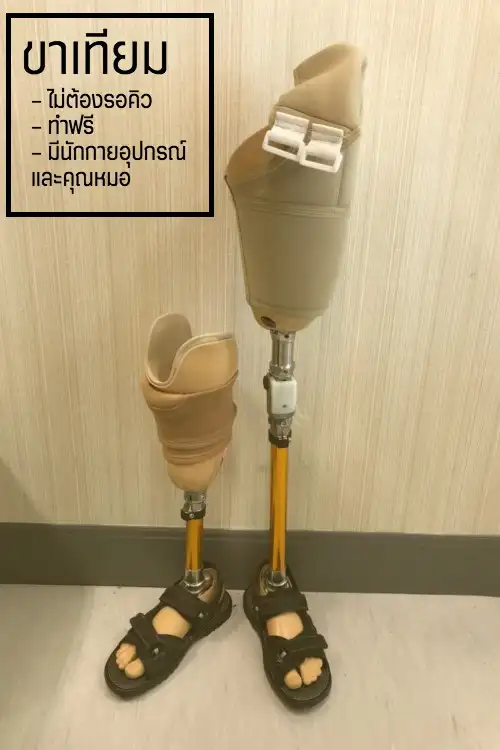 งานกายอุปกรณ์โรงพยาบาลบางกรวย ขาเทียมและแผ่นเสริมรองเท้าทางการแพทย์ ทำขาเทียม คนพิการ มีที่ไหนให้บริการบ้าง