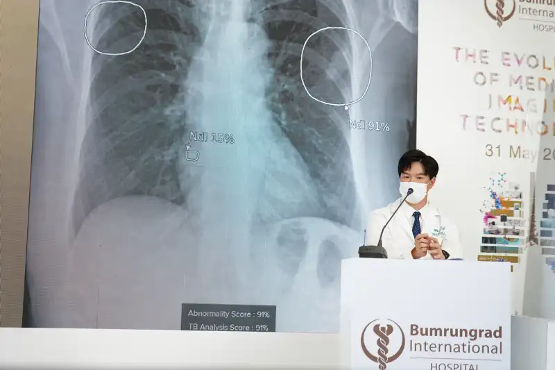 บำรุงราษฎร์ เปิดตัว Radiology AI ปัญญาประดิษฐ์ พิชิตมะเร็งเต้านม ช่วยชีวิตสตรีไทย