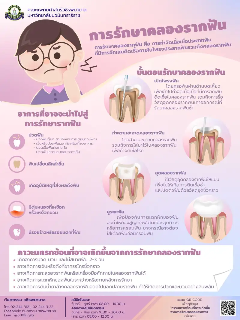 การรักษาคลองรากฟัน คืออะไร รอบรู้เรื่องทันตกรรม ปากและฟัน (ทันตกรรม วชิรพยาบาล)