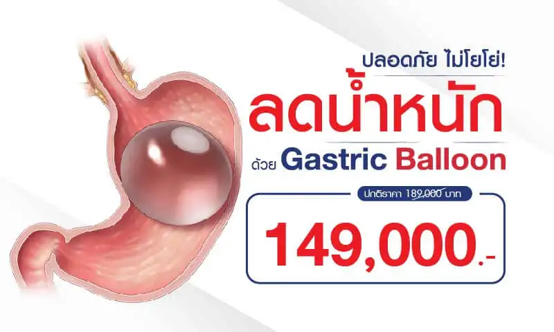 โรงพยาบาลจุฬารัตน์ 9 แอร์พอร์ต ลดความอ้วนด้วยบอลลูน Gastric balloon ราคาพิเศษ 149,000 บาท แพคเกจผ่าตัดลดอ้วน ผ่าตัดส่องกล้องลดกระเพาะ ราคาเท่าไหร่ รพ.ไหนบ้าง