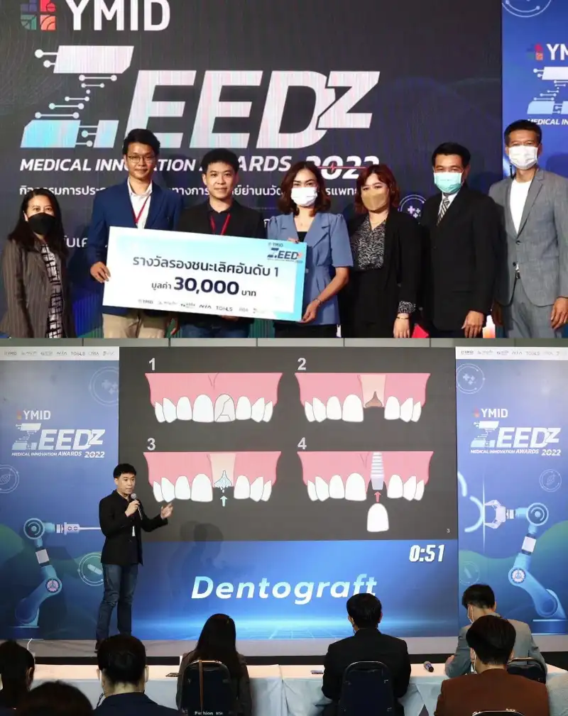 รางวัลรองชนะเลิศอันดับ 1 ทีม Dentograft ประกาศผลรางวัล YMID ZEEDz Medical Innovation Awards 2022