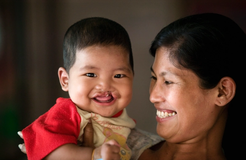  มูลนิธิสร้างรอยยิ้มและฟูจิฟิล์ม เดินหน้าช่วยผู้ป่วยปากแหว่งเพดานโหว่ ผ่านโครงการ 100 รอยยิ้ม