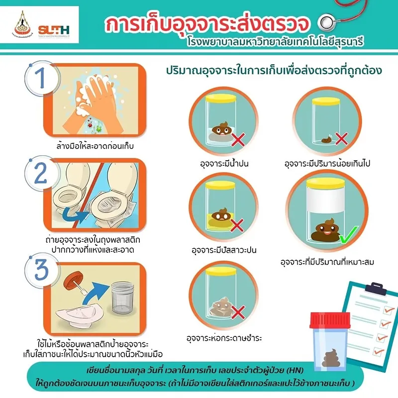การเก็บอุจจาระส่งตรวจ โปรแกรมตรวจสุขภาพ รพ.ม.เทคโนโลยีสุรนารี (3 กลุ่ม)