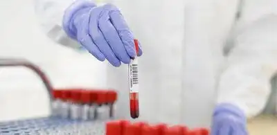 โรชร่วมมือกับโมเดอร์นา นำการตรวจหาภูมิต้านทานต่อเชื้อซาร์ส-โควี-ทู ไปใช้ในระยะทดลองของการฉีดวัคซีนต้านโรคโควิด-19 HealthServ.net