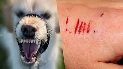 โรคพิษสุนัขบ้า (Rabies) และความน่ากลัวของโรคนี้ HealthServ.net