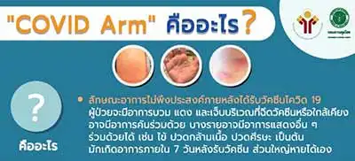COVID Arm อาการไม่พึงประสงค์ภายหลังได้รับวัคซีน ที่ต้องรู้ไว้ HealthServ.net