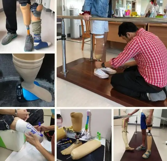 ผู้พิการทำขาเทียมฟรี เพียง 10 สิทธิ ติดต่องานกายอุปกรณ์ โรงพยาบาลบางกรวย HealthServ.net
