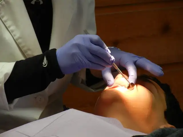 มีอาการฟันคุด อยากผ่าฟันคุด-ถอดฟันคุด ราคาเท่าไหร่ ที่ไหนทำได้บ้าง HealthServ.net