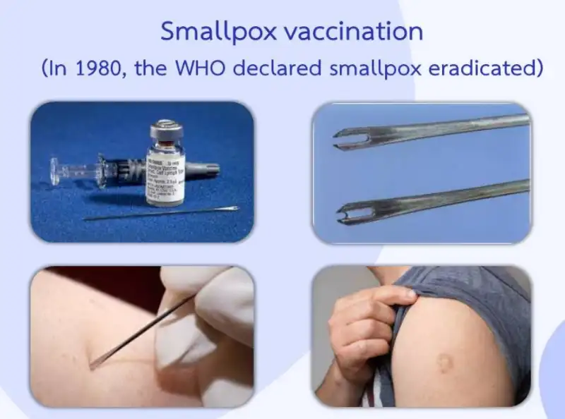 สธ.ชี้ คนเคยได้รับวัคซีนฝีดาษคน 40 ปีก่อน ไม่มีภูมิป้องกันฝีดาษลิง พ.ศ.นี้ HealthServ.net