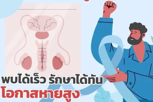 หนุนชายไทยอายุ 45-75 ปี ตรวจคัดกรอง มะเร็งต่อมลูกหมาก HealthServ.net