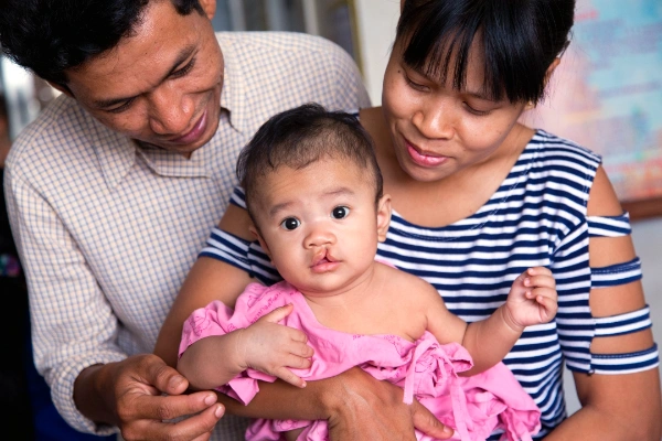 มูลนิธิสร้างรอยยิ้มและฟูจิฟิล์ม เดินหน้าช่วยผู้ป่วยปากแหว่งเพดานโหว่ ผ่านโครงการ 100 รอยยิ้ม