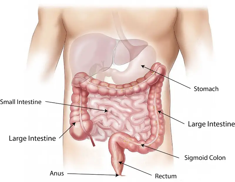 มะเร็งลำไส้ใหญ่ (Colon cancer) และมะเร็งลำไส้ตรง (rectum) HealthServ