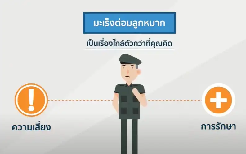 มะเร็งต่อมลูกหมาก อันตรายที่ชายไทยอายุ 50 ปีขึ้นไปต้องตระหนัก HealthServ
