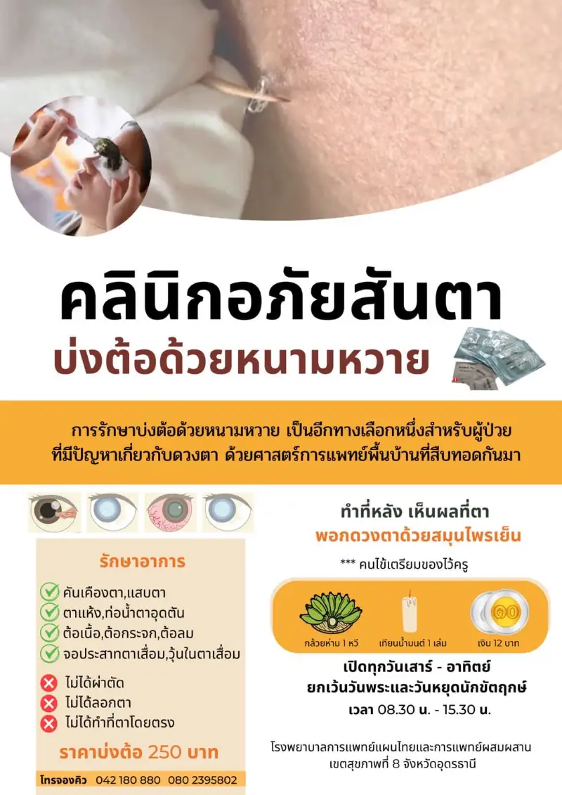 บ่งต้อด้วยหนามหวาย โรงพยาบาลการแพทย์แผนไทย อุดรธานี HealthServ
