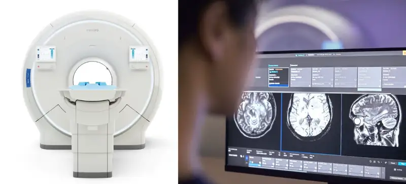ฟิลิปส์ เปิดตัว เครื่อง MRI เทคโนโลยี AI SmartSpeed สแกนเร็วขึ้น 3 เท่า HealthServ