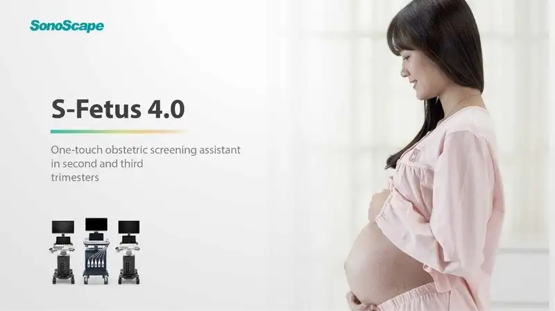 โซโนสเคป เปิดตัวซอฟต์แวร์ "เอส-ฟีตัส 4.0" ช่วยให้การตรวจอัลตราซาวด์ง่ายขึ้น HealthServ