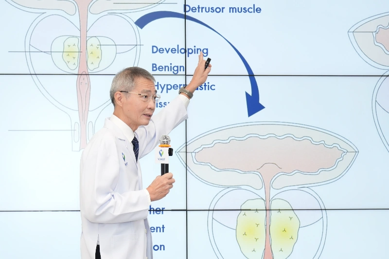 รพ.วิมุตเปิดตัวศูนย์เดินปัสสาวะ ชูนวัตกรรม UROLIFT รักษาต่อมลูกหมากโต HealthServ