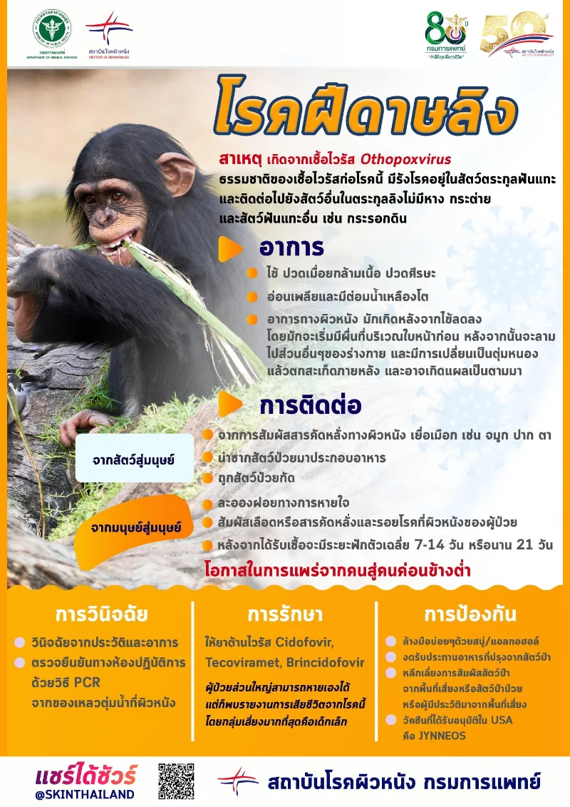 โรคฝีดาษลิง Monkeypox กลุ่มเสี่ยงมากที่สุดคือเด็กเล็ก HealthServ