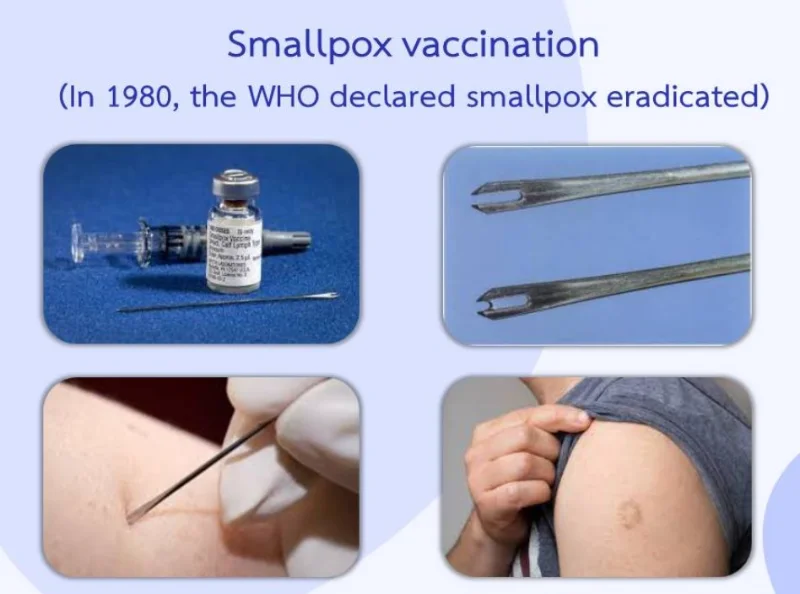 สธ.ชี้ คนเคยได้รับวัคซีนฝีดาษคน 40 ปีก่อน ไม่มีภูมิป้องกันฝีดาษลิง พ.ศ.นี้ HealthServ