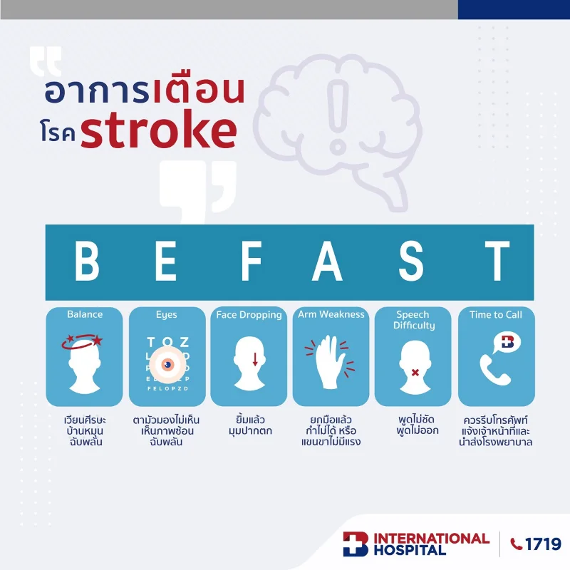 หลักการ BEFAST รู้ไว ปลอดภัยจากโรคหลอดเลือดสมอง HealthServ