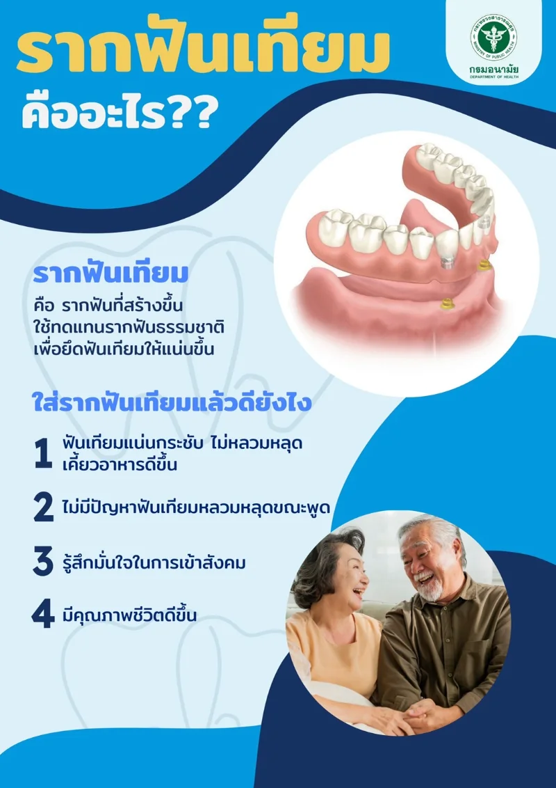 รากฟันเทียม คืออะไร ใส่รากฟันเทียมแล้วดียังไง HealthServ