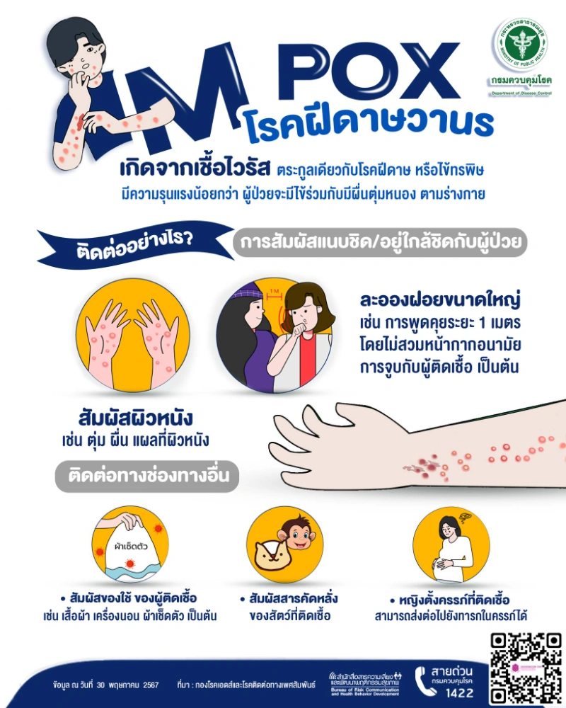 [Infographic] Mpox โรคฝีดาษวานร (monkeypox) รู้ไว้ ป้องกันได้ HealthServ