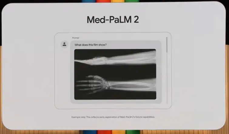 PaLM 2 บน Google Bard AI พลิกโฉมการแพทย์ และทักษะใหม่ที่แพทย์ต้องมี HealthServ
