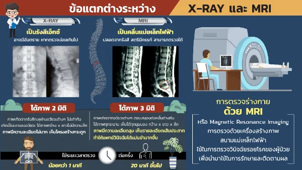 ตอบข้อสงสัย ผู้ป่วยโรคกระดูกสันหลัง X-RAY แล้วทำไมต้องทำ MRI อีกล่ะ HealthServ