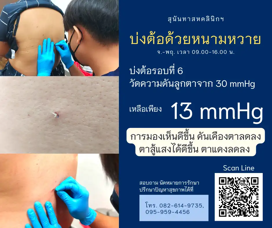 สุนันทาสหคลินิก พร้อมให้บริการ แพทย์แผนไทยประยุกต์-กายภาพบำบัด คลินิกกัญชาทางการแพทย์แผนไทย HealthServ