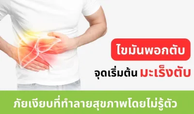 ภาวะไขมันพอกตับ ต้นตอสู่ มะเร็งตับ พบมากเป็นอันดับ 1 ของคนไทย Thumb HealthServ.net