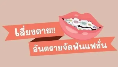 จัดฟันแฟชั่นหมอเถื่อน เสี่ยงมาก หมอเตือน Thumb HealthServ.net