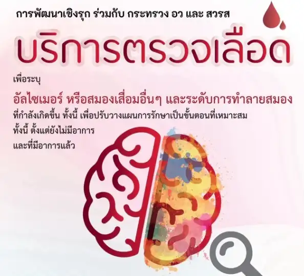 บริการตรวจเลือด ระบุอัลไซเมอร์หรือสมองเสื่อม คณะแพทย์ จุฬาฯ HealthServ.net