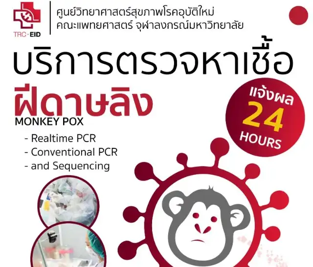 บริการตรวจหาเชื้อ MONKEY POX ฝีดาษลิง คณะแพทยศาสตร์ จุฬา HealthServ.net