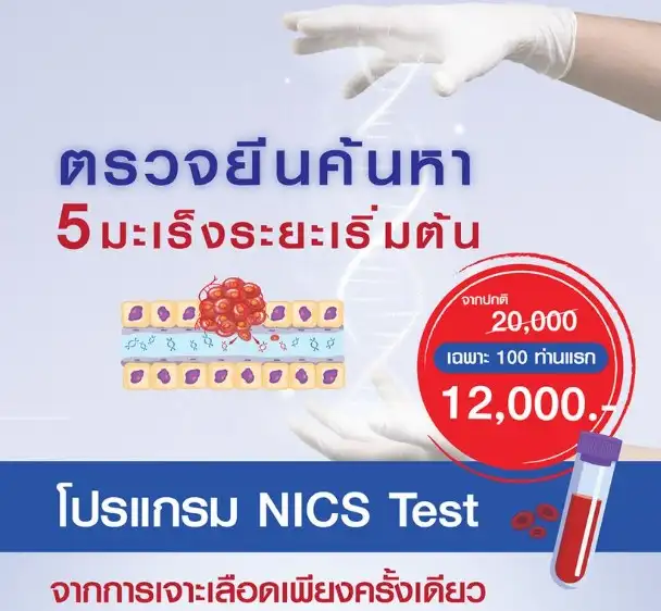 NICS Test เจาะเลือด ตรวจหามะเร็งในระยะเริ่มต้น โรงพยาบาลจุฬารัตน์ระยอง  Healthserv.net